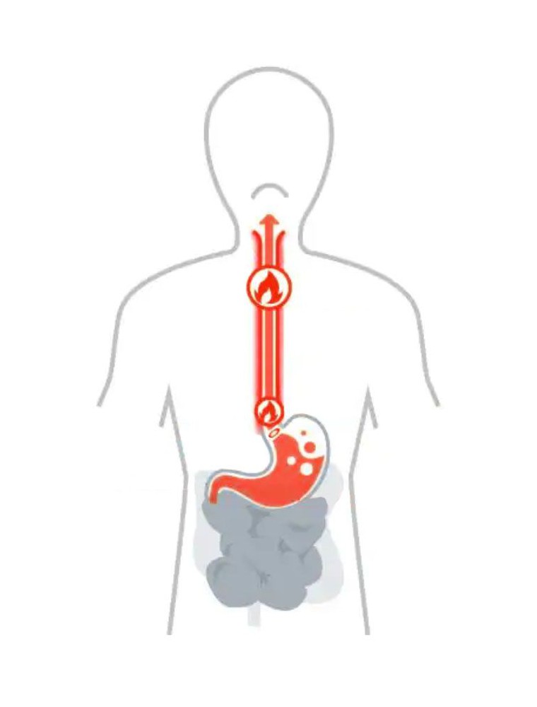 Image principale de la modale pour Recette contre l'acidité de l'estomac - Les Coffrets de l'Herboriste