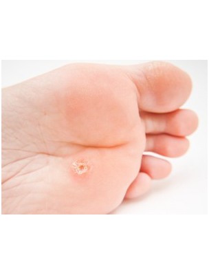 https://www.louis-herboristerie.com/9579-home_default/celidonia-organic-mother-tincture-50-ml-wart-ladrome.jpg