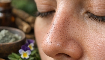 Remèdes de grand-mère contre les points noirs